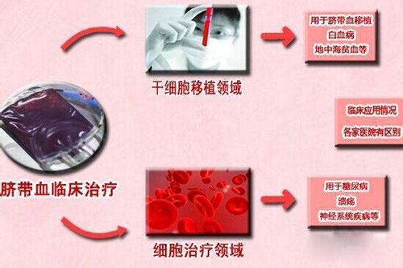 脐带血储存